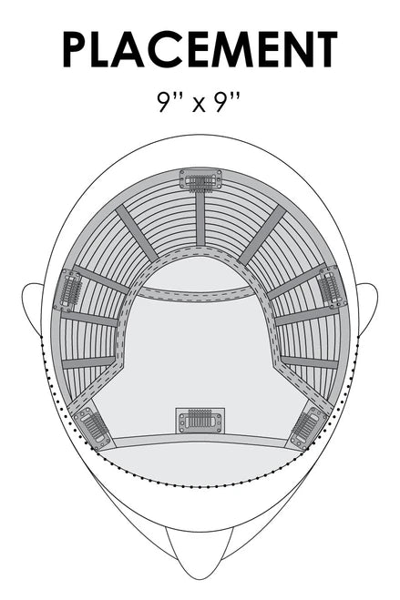 Top Smart 18" clip placement diagram